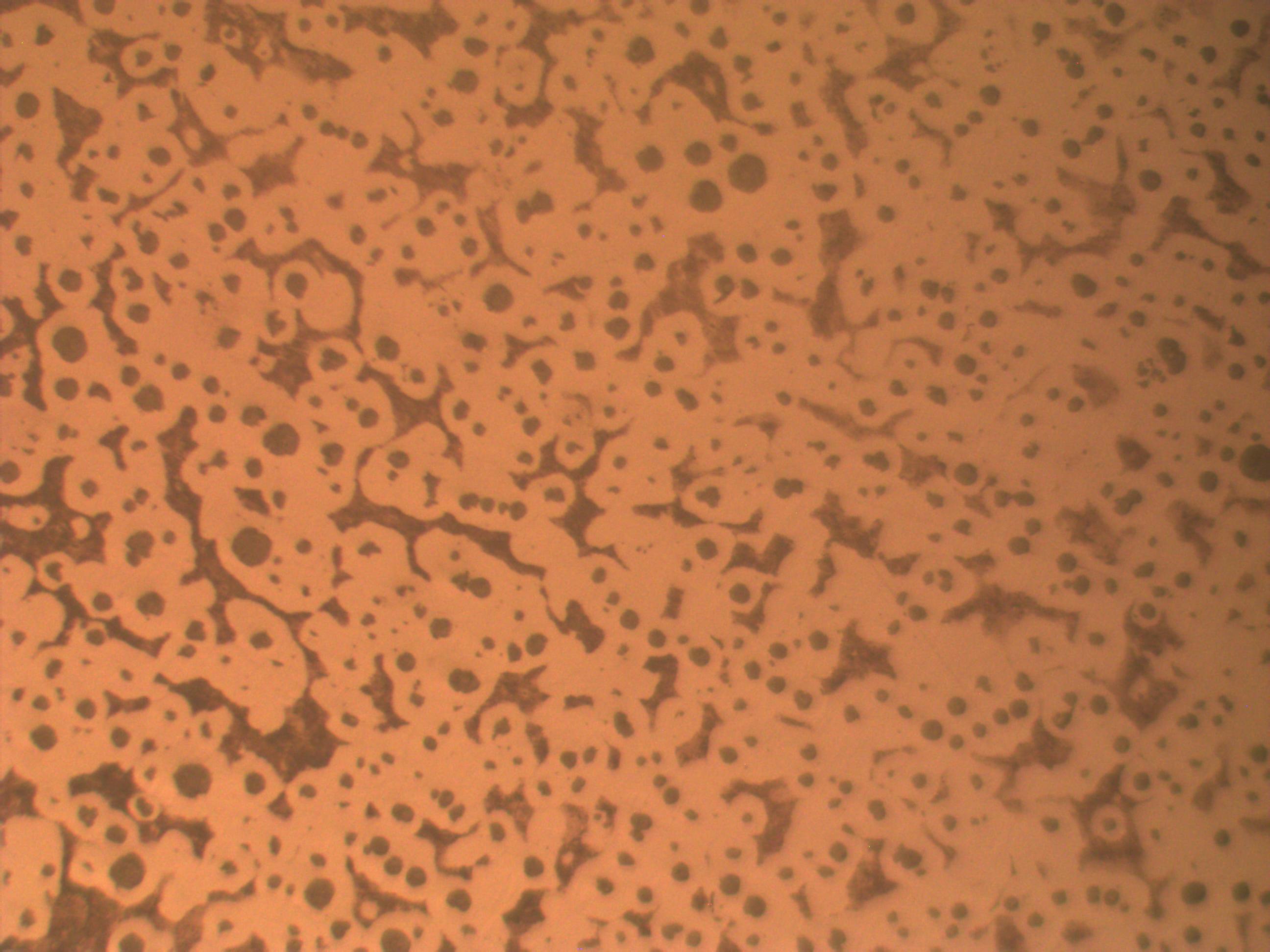 nodular3_SZ2